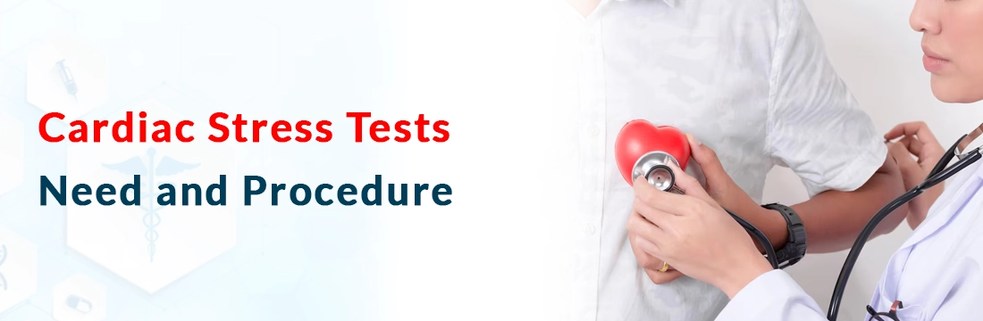  Cardiac Stress Tests: Need and Procedure